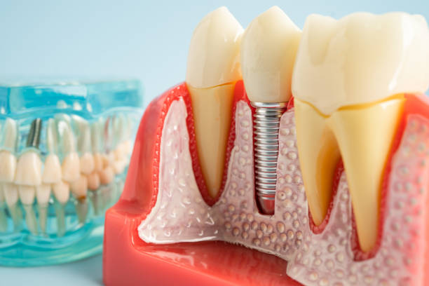 Best Dental Exams and Cleanings  in Lake Linden, MI